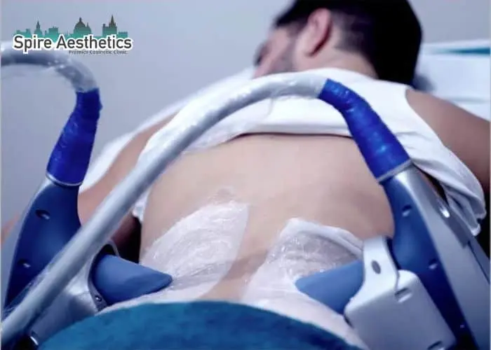 Man having fat freezing treatment done on love handles before a competitions Ayr to create a sculpted look.