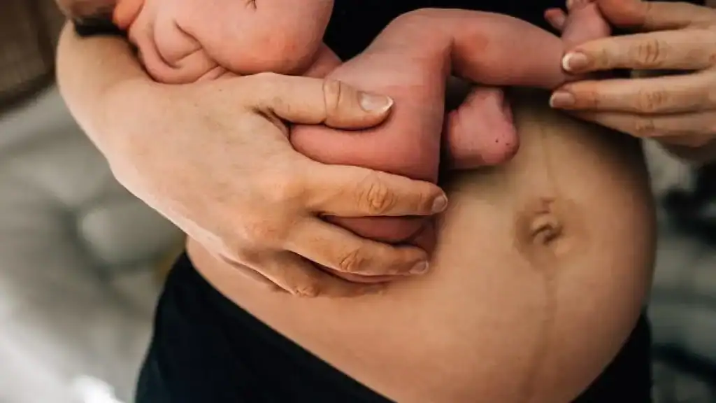 Why Is My Stomach Still Big After Pregnancy Ayr?